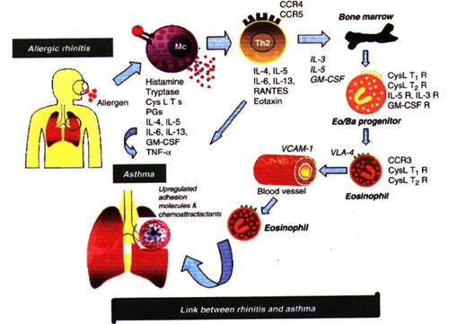 Diagram showing IgE mediated allergic reaction causing hay fever symptoms